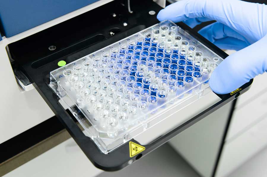 Técnica ELISA